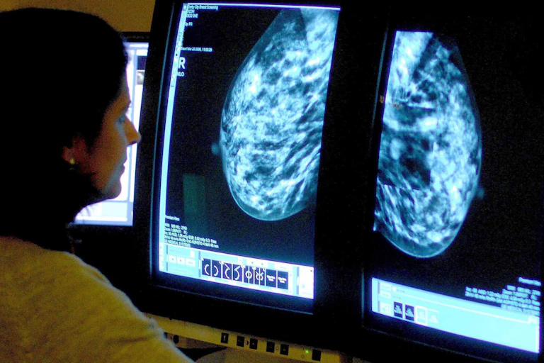 A woman looks at a medical scan on a screen.