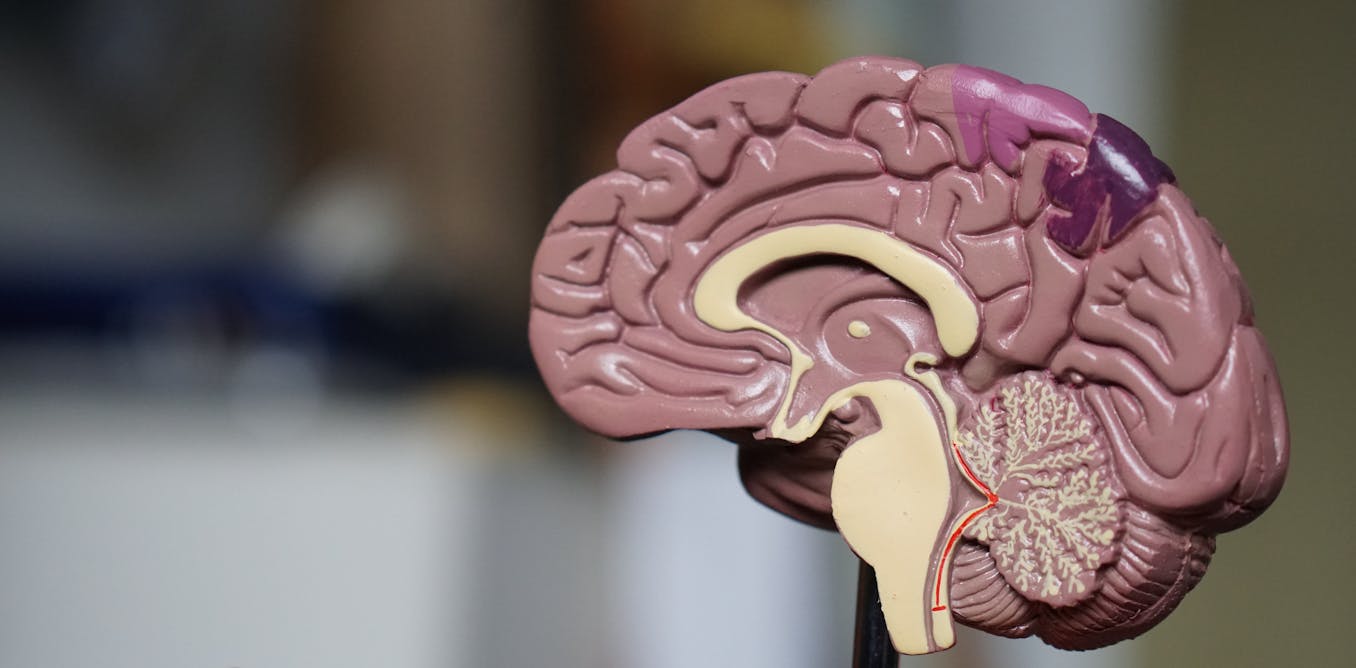 Qu Est Ce Que La Plasticite Cerebrale Qu Est Ce Que La Plasticite Cerebrale