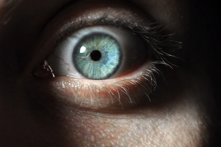Picture of an eye showing fear.