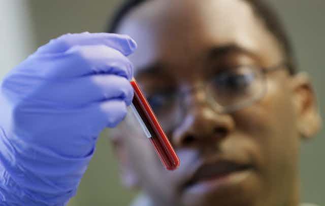 The blurred face of a young Black man wearing glasses in the background, with his gloved hand holding a vial of blood in the foreground.
