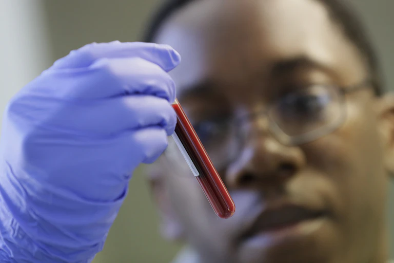 The blurred face of a young Black man wearing glasses in the background, with his gloved hand holding a vial of blood in the foreground.