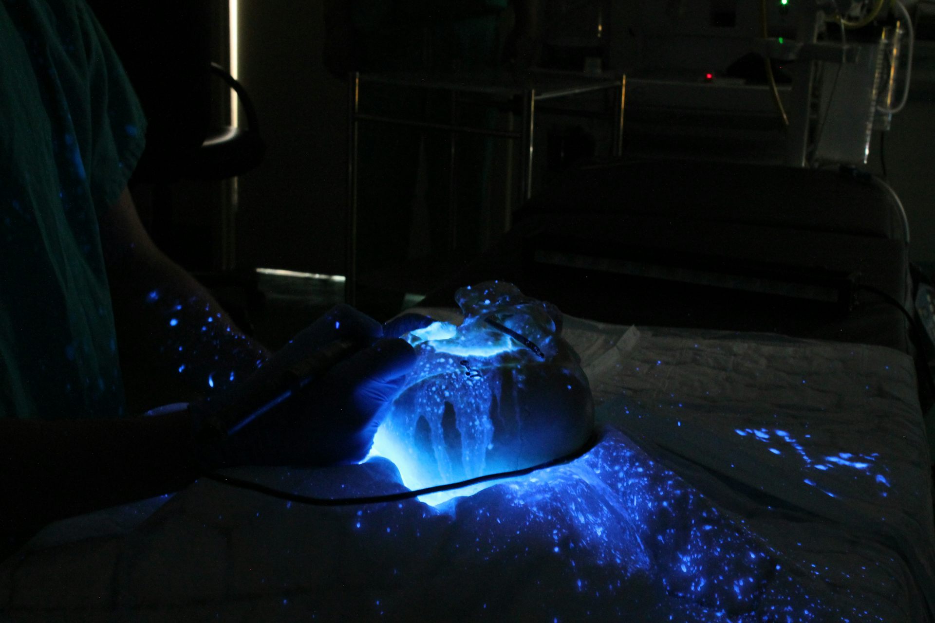 Flouescent dye covers part of an operating table and a skull against a black background.