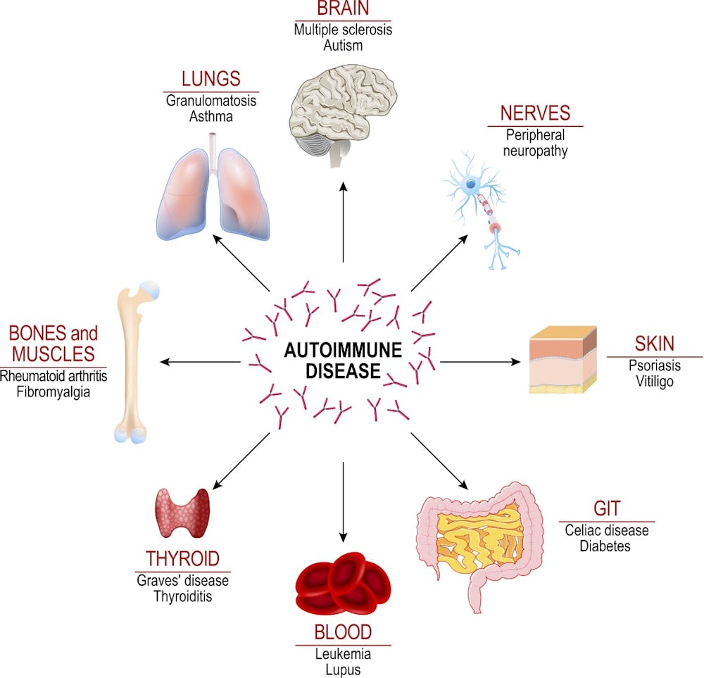 autoimmune disease psoriasis and covid