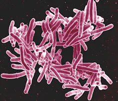 A cluster of pink rod-shaped bacteria on a black background