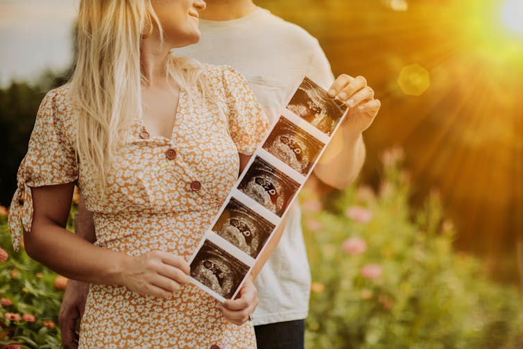 Couple holds ultrasound print out.
