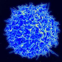 A round blue T cell with a rough surface against a black background