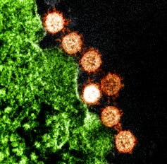 Orange coronavirus particles lined up diagonally along the edge of a green cell, against a black background