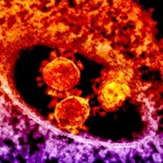 Three orange coronavirus particles surrounded by a ring of orange and purple against a black background