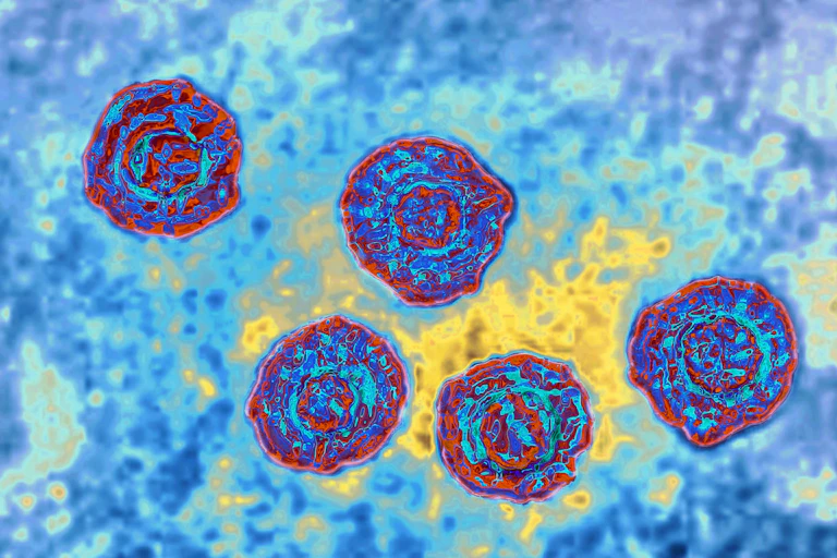 Transmission electron microscope image of Hepatitis C