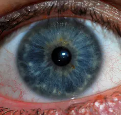 Ojo humano con iris azul.
