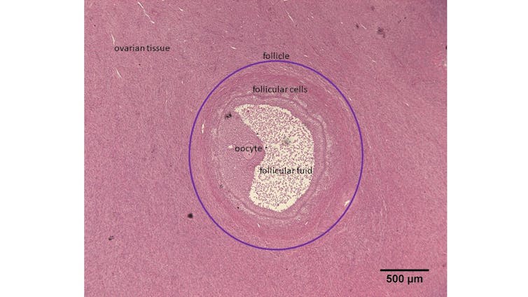 A mass of white tissue (the follicle) within the surrounding pink ovarian tissue.
