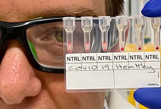 medical researchers looks at blood samples being used to test for COVID-19