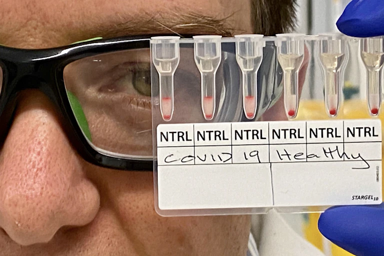 medical researchers looks at blood samples being used to test for COVID-19
