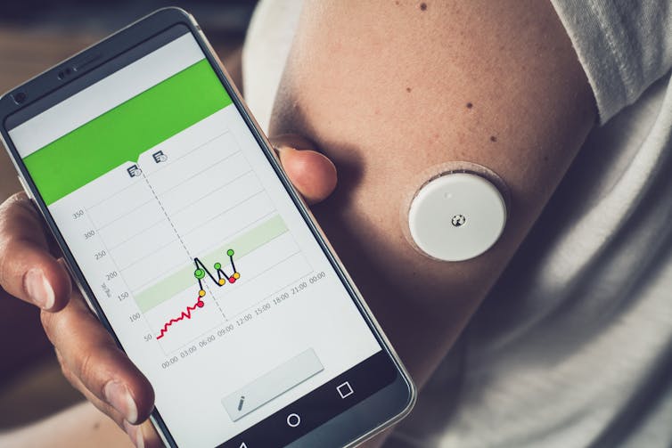 A woman holds up her phone which displays results from her blood glucose monitoring device, shown on her arm.