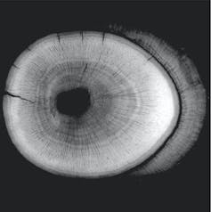 X-ray image of round shape containing concentric rings.