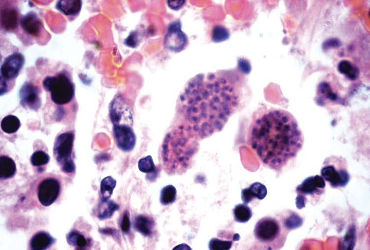 The parasite _Toxoplasma gondii_