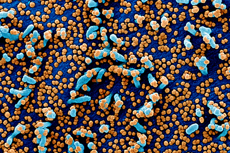 Cellule infectée par des particules de SARS-CoV-2