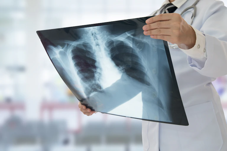 A doctor examines a chest X-ray