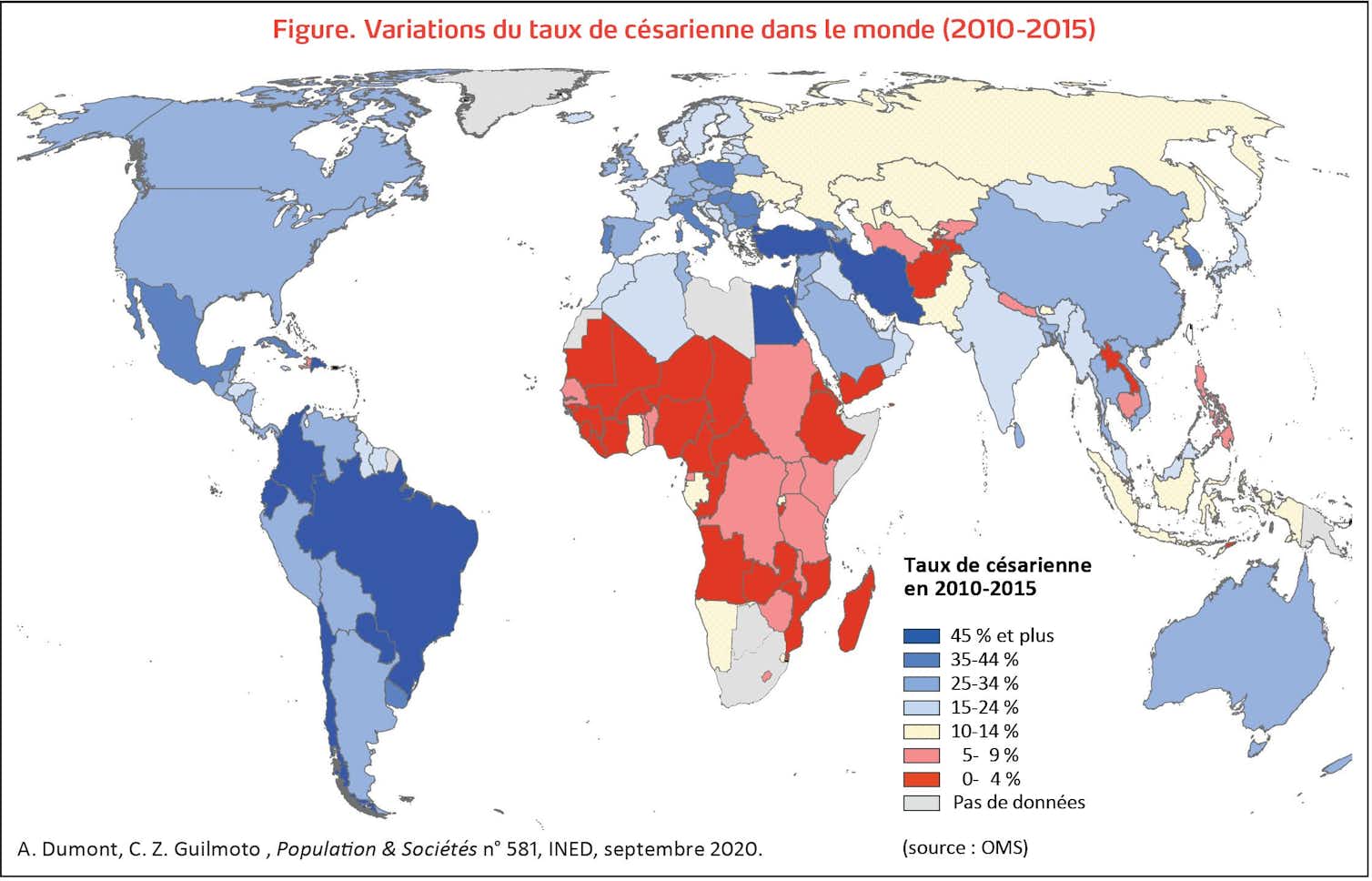 Les césariennes sont-elles devenues trop fréquentes