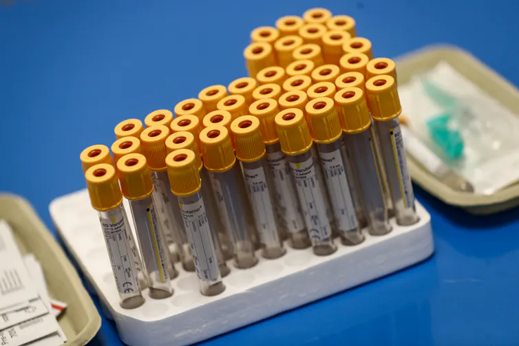 A set of empty blood vials for collecting samples for antibody tests