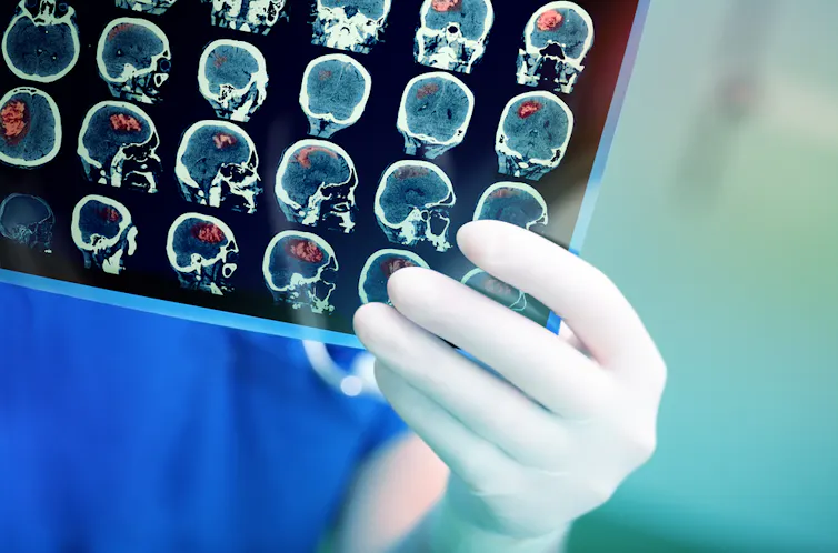 A medic examines a scan of a patient's head.