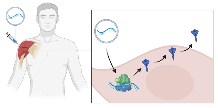 Infographic showing how mRNA vaccines work