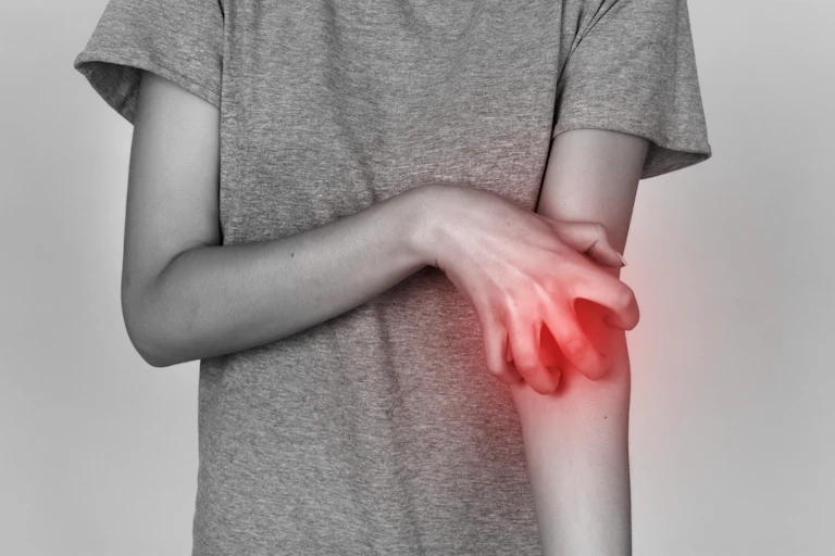 Person scratching their arm.