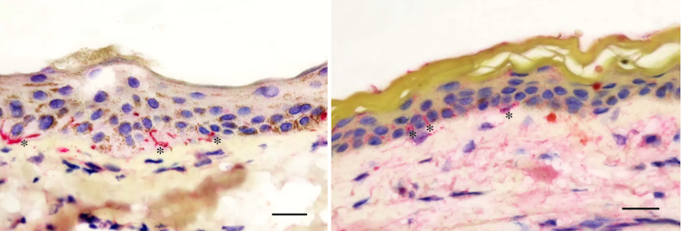 Cross-sections of horse and human skin.