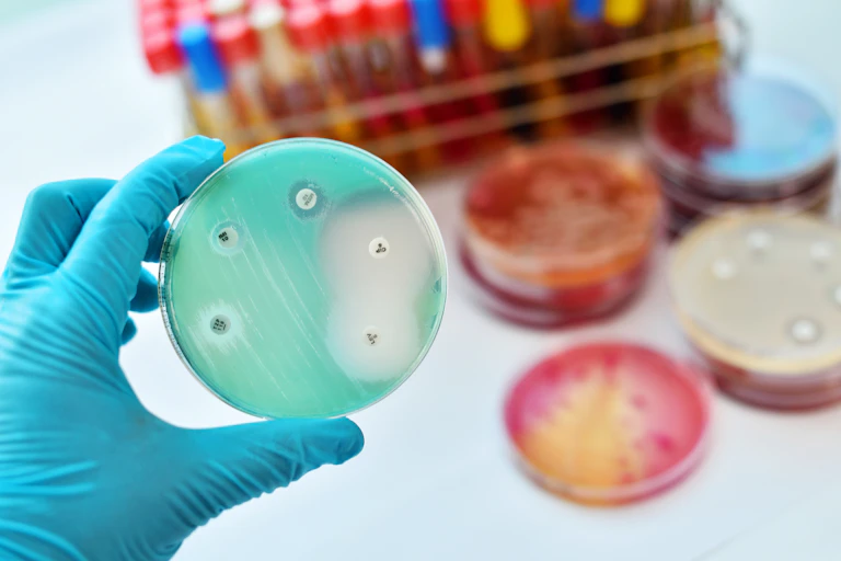 Placa de petri con cultivo microbiano.