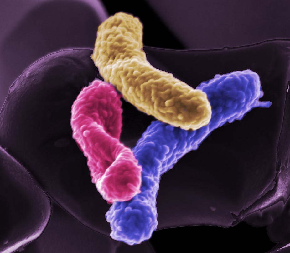 Probiotic Therapy Alleviates Autism >> Link Between Gut And Brain Suggests Therapies For Autism Probiotic Therapy Alleviates Autism >> Link Between Gut And Brain Suggests Therapies For Autism