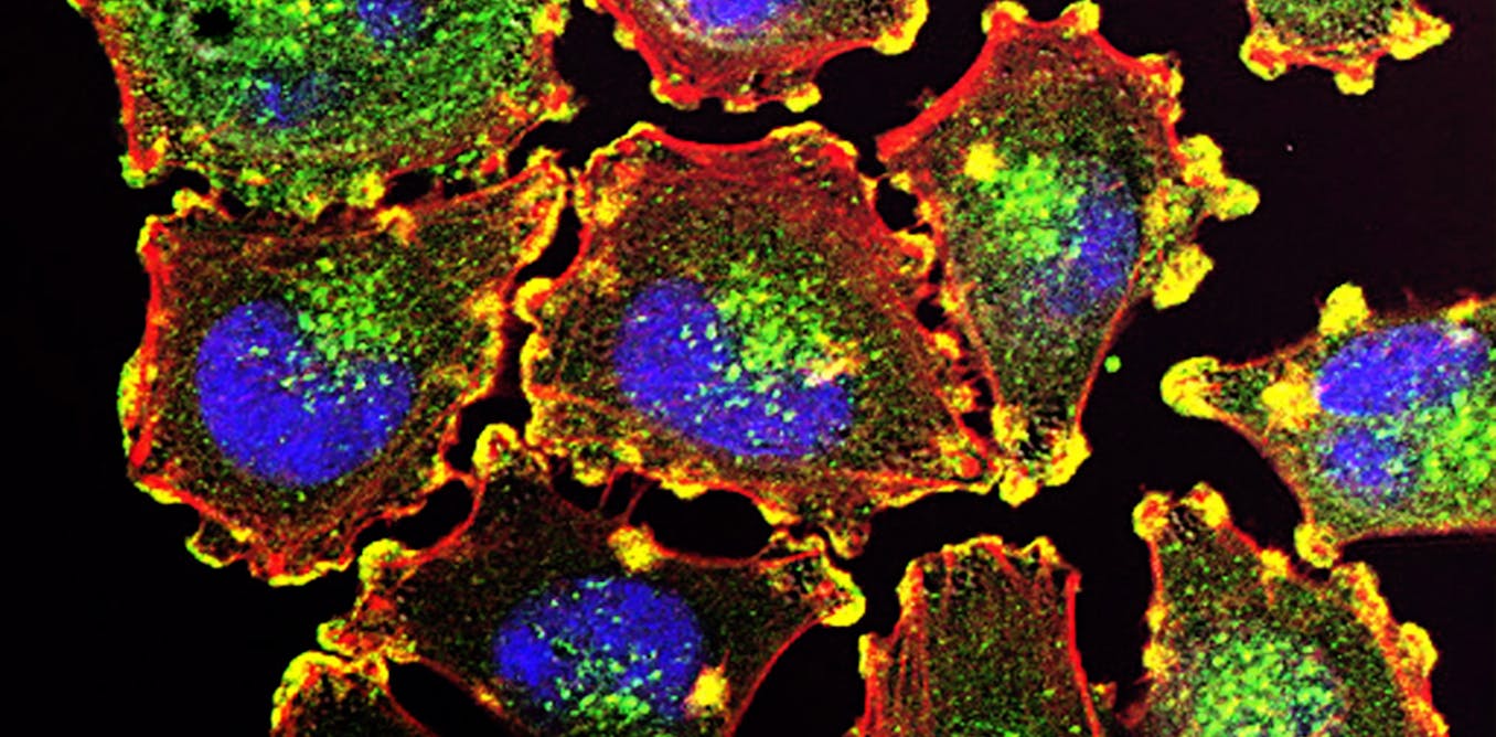 La senescencia celular el gran desafío para entender y tratar el cáncer