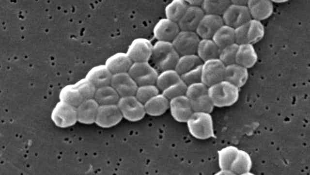 A scanning electron micrograph image of a type of bacteria called Acinetobacter baumannii