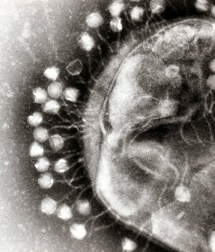 Electron micrograph image of multiple bacteriophages attached to a bacterial cell wall