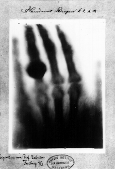 Wilhelm Röntgen's X-ray of his wife's hand.