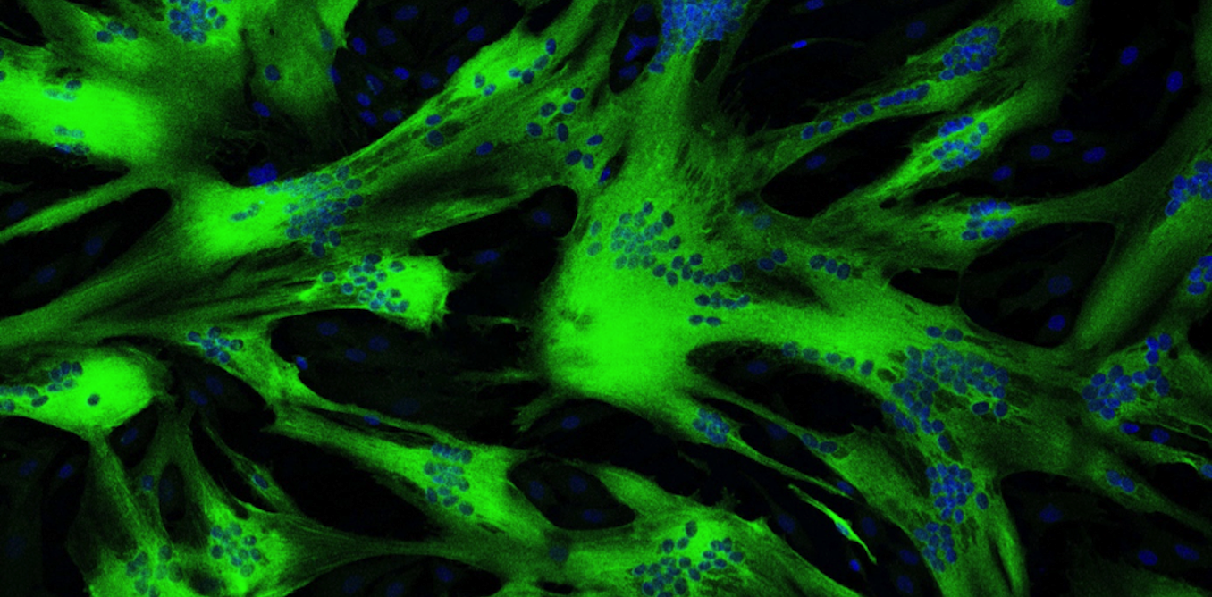 Veja as células musculares em um microscópio fluorescente Veja as células musculares em um microscópio fluorescente
