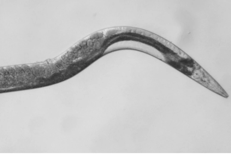 Microscopic shot of a worm.