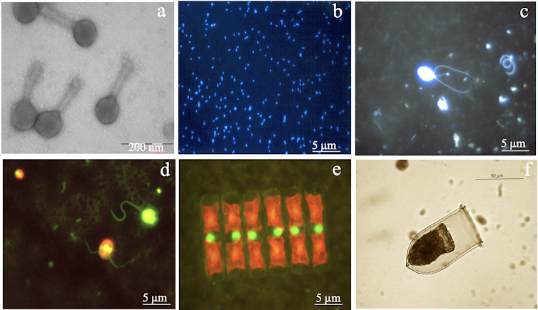 Virus y microorganismos marinos. a) virus; b) bacterias; c) protozoo (nanoflagelado heterotrófico); d) microalga (nanoflagelados fototrófico, con cloroplastos rojo-naranja) y protozoo (nanoflagelado heterotrófico, amarillo); e) microalgas (diatomeas); f) protozoo (ciliado). E. Lara, D. Vaqué y J.M. Gasol, Author provided