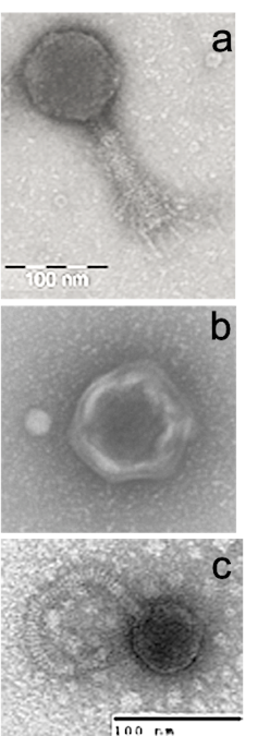 Diferentes familias de virus de doble cadena de ADN. De arriba abajo: Myoviridae, Podoviridae y Syphoviridae. Author provided