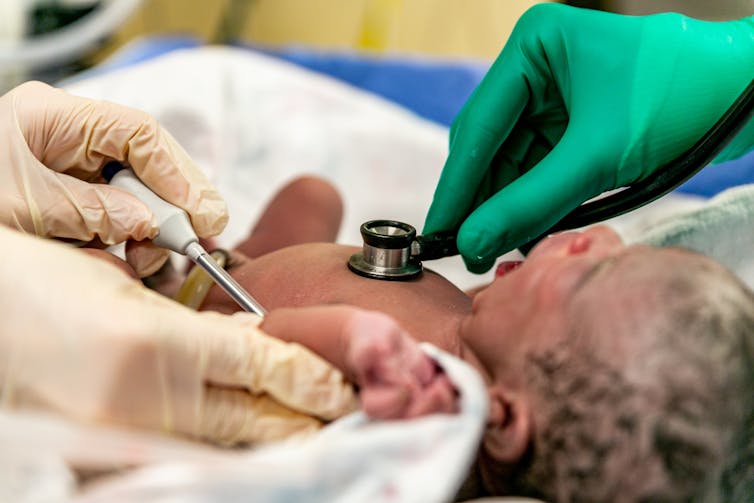A newborn baby is examined by medical staff.