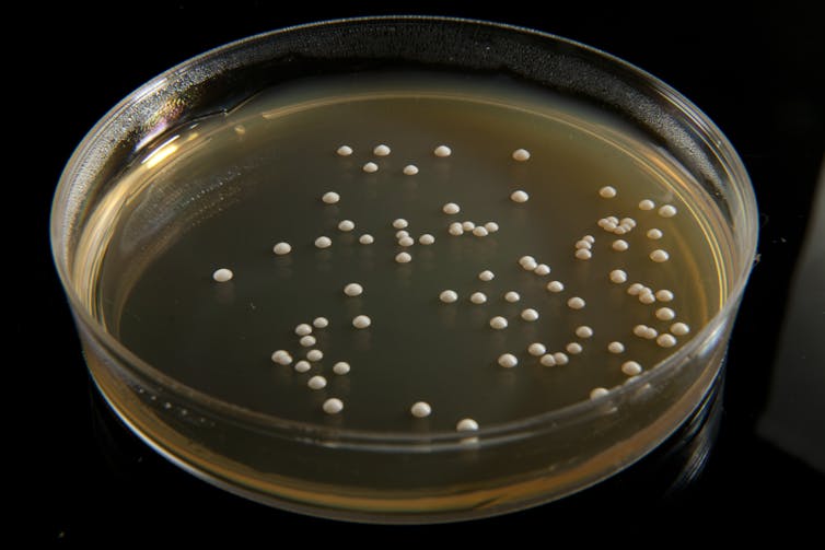 A petri dish of Saccharomyces cerevisiae yeast grown in the lab.