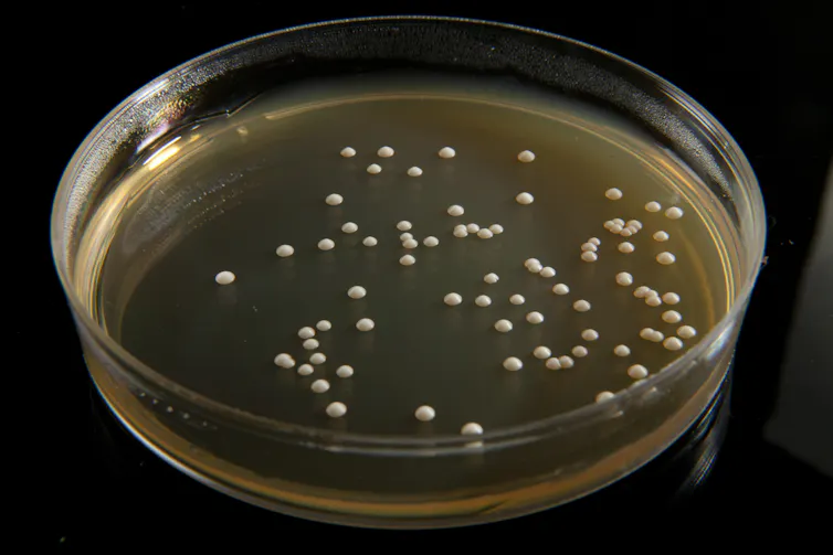 A petri dish of Saccharomyces cerevisiae yeast grown in the lab.