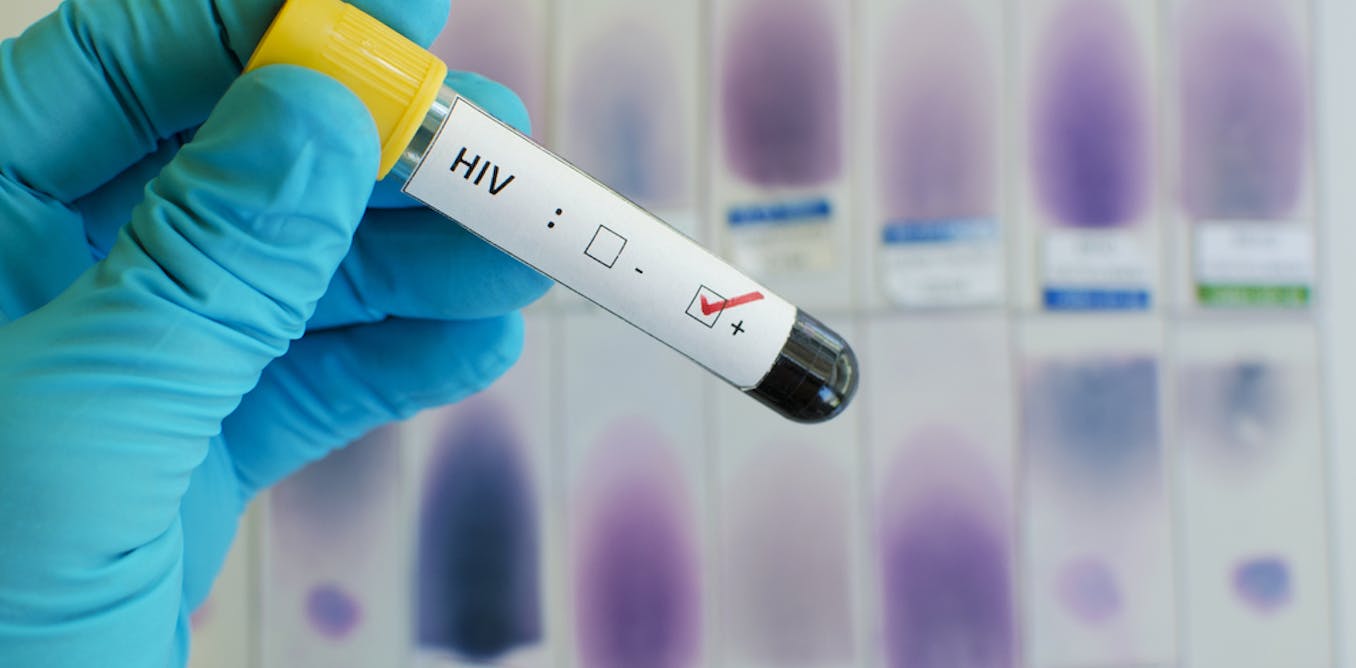 Here’s where efforts to end HIV in eastern and southern Africa must focus