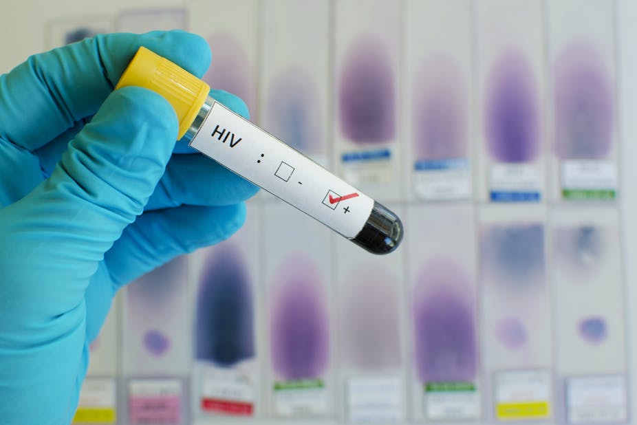 In a laboratory, a hand in a blue glove holds up a vial of blood indicating a HIV positive test result.