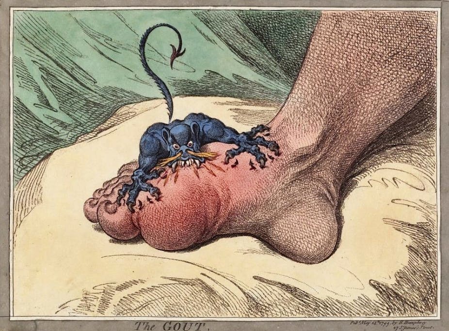 An illustration of a demon attacking a gout-affected foot.