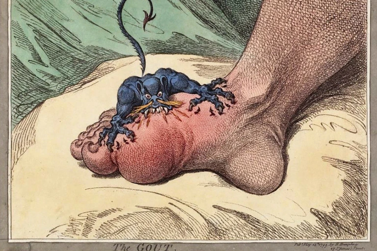 An illustration of a demon attacking a gout-affected foot.