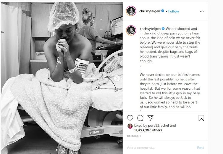 Chrissy Teigen sits in a hospital bed with her head bowed.