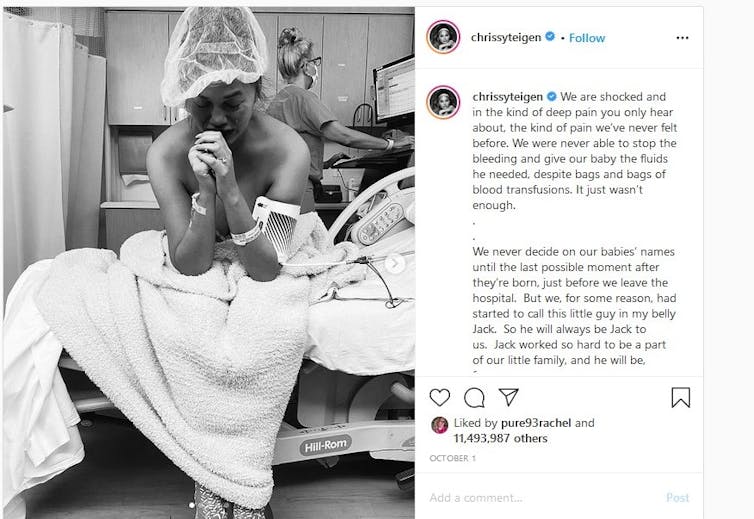 Chrissy Teigen dans un lit d'hôpital