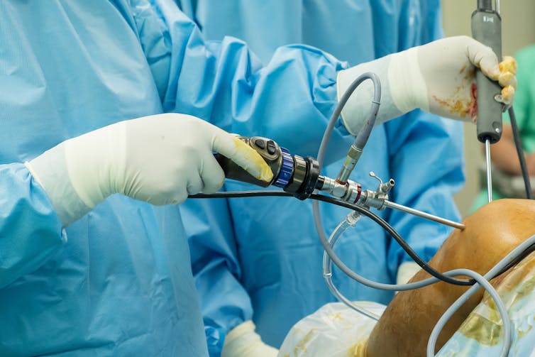 Surgeon operating on a patient's knee.