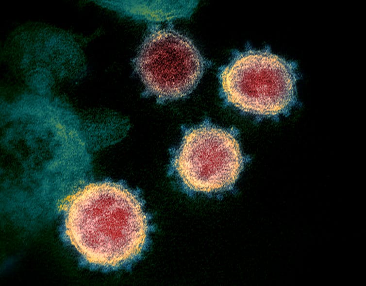 Transmission electron microscope image showing four SARS-CoV-2 virus particles.
