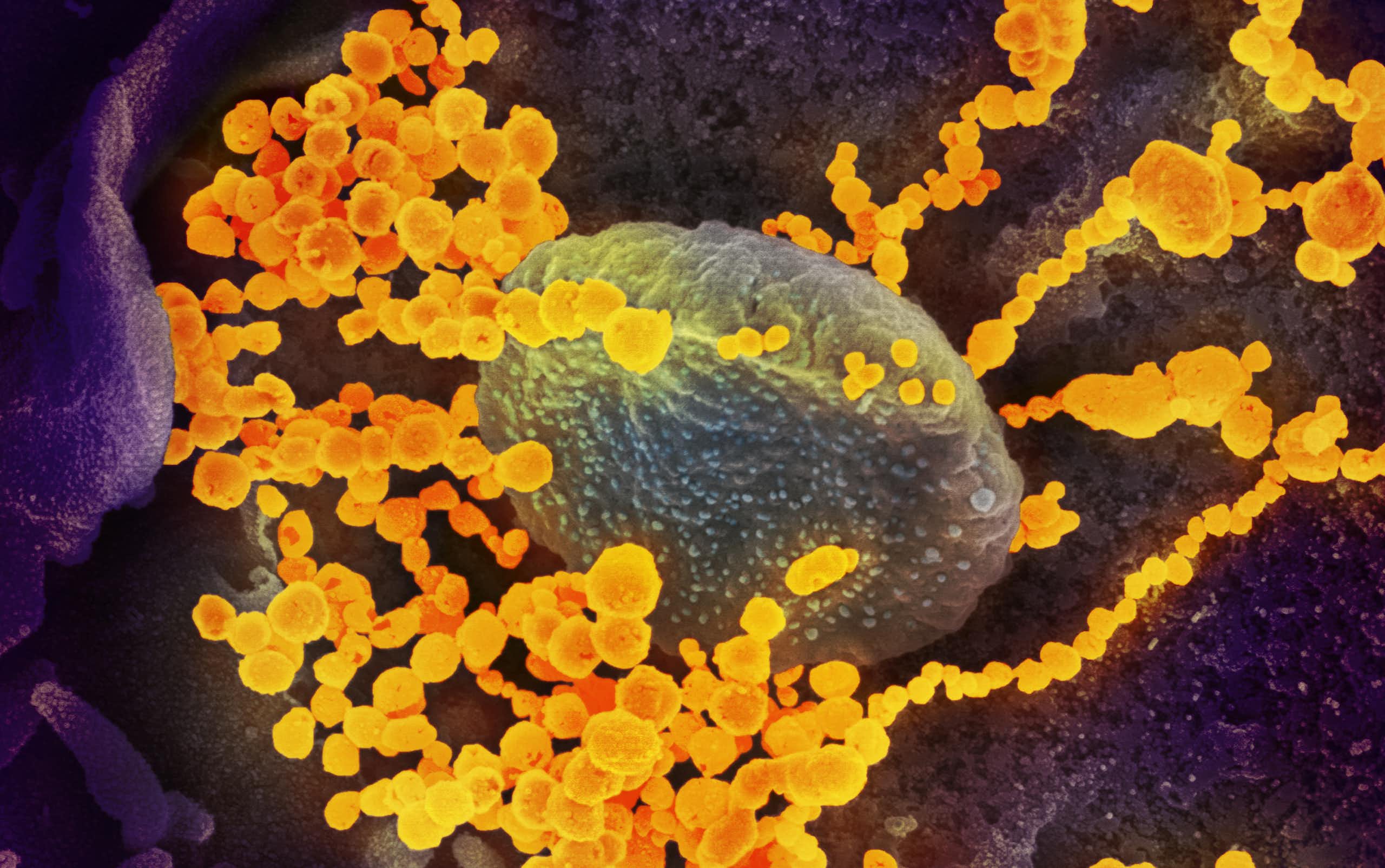 Comment notre corps se défend-il contre les envahisseurs ?